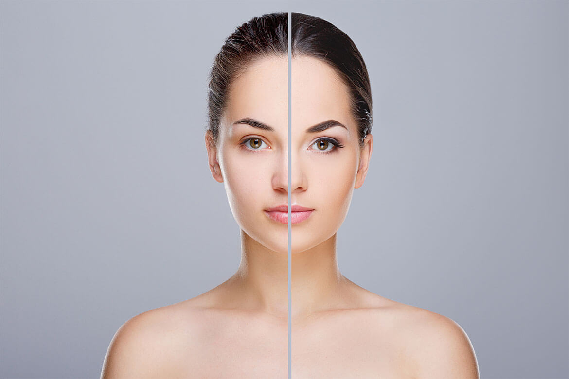 before_after_02